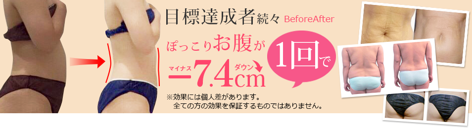 目標達成者続々ぽっこりお腹が1回でマイナス4cmダウン